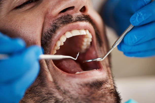 Best Emergency Dental Care for Sports Injuries in Granger, IN