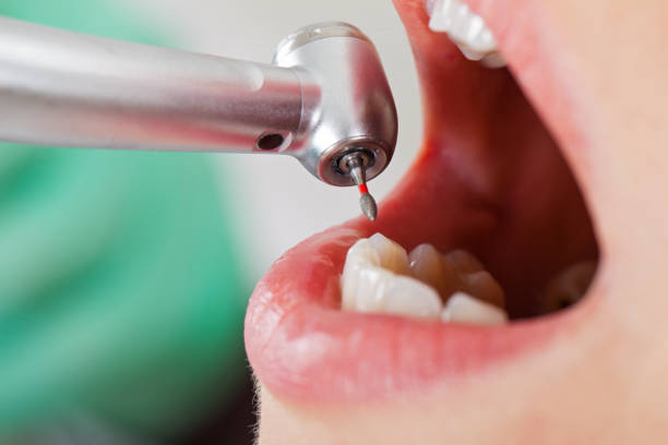 Best Emergency Cosmetic Dentistry (e.g., broken veneers) in Granger, IN
